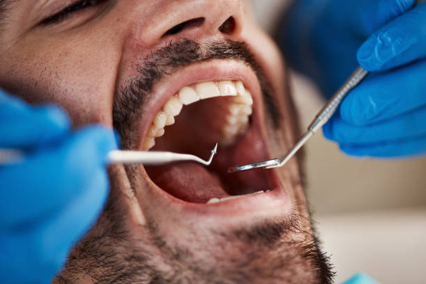 Best Emergency Cosmetic Dentistry in Savoy, IL